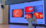 爱护眼睛，从我做起——记丰茂幼儿园爱眼护眼知识科普活动